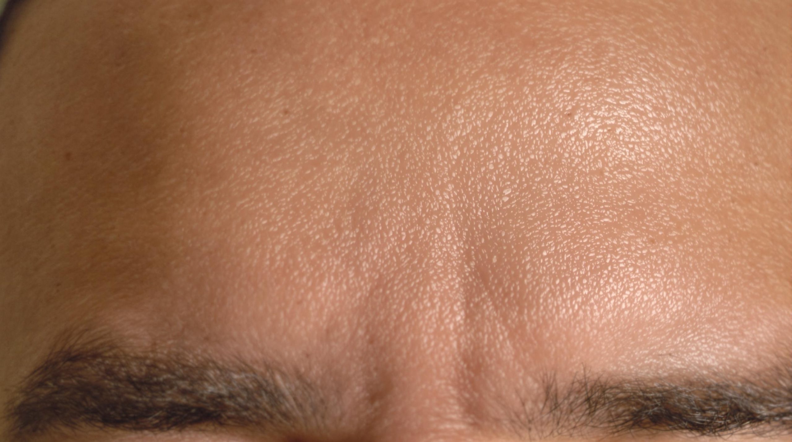 Understanding and treating granular skin on the forehead - My Beauty Vedia